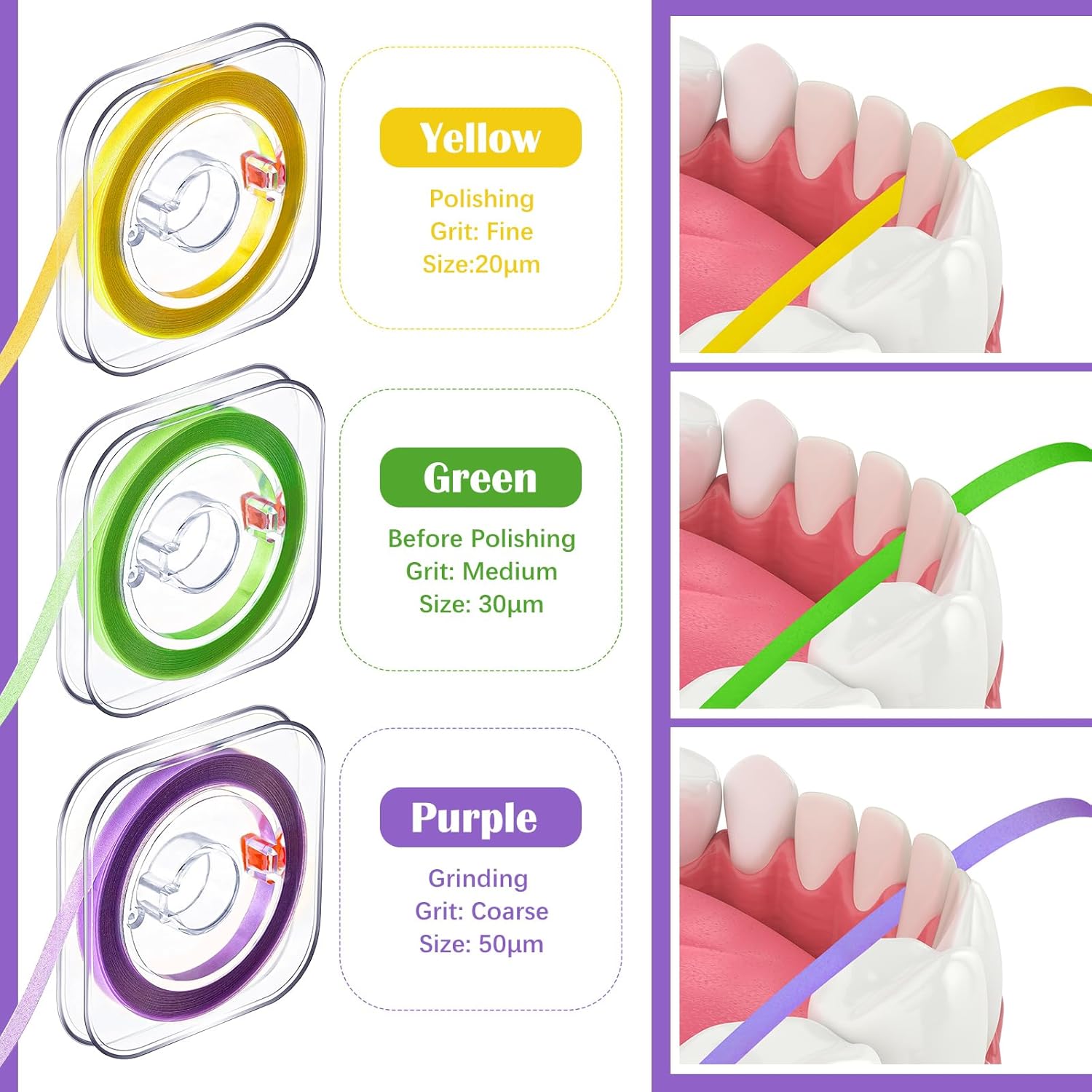 Amylove Dental Polishing Strips Tooth File 3 Rolls 4mm x 600mm Dental Polisher Teeth Sanding Grinding Deep Teeth Cleaning Tool Tooth Polish Abrasive Strip Oral Care Coarse, Fine, Medium,Multi Color