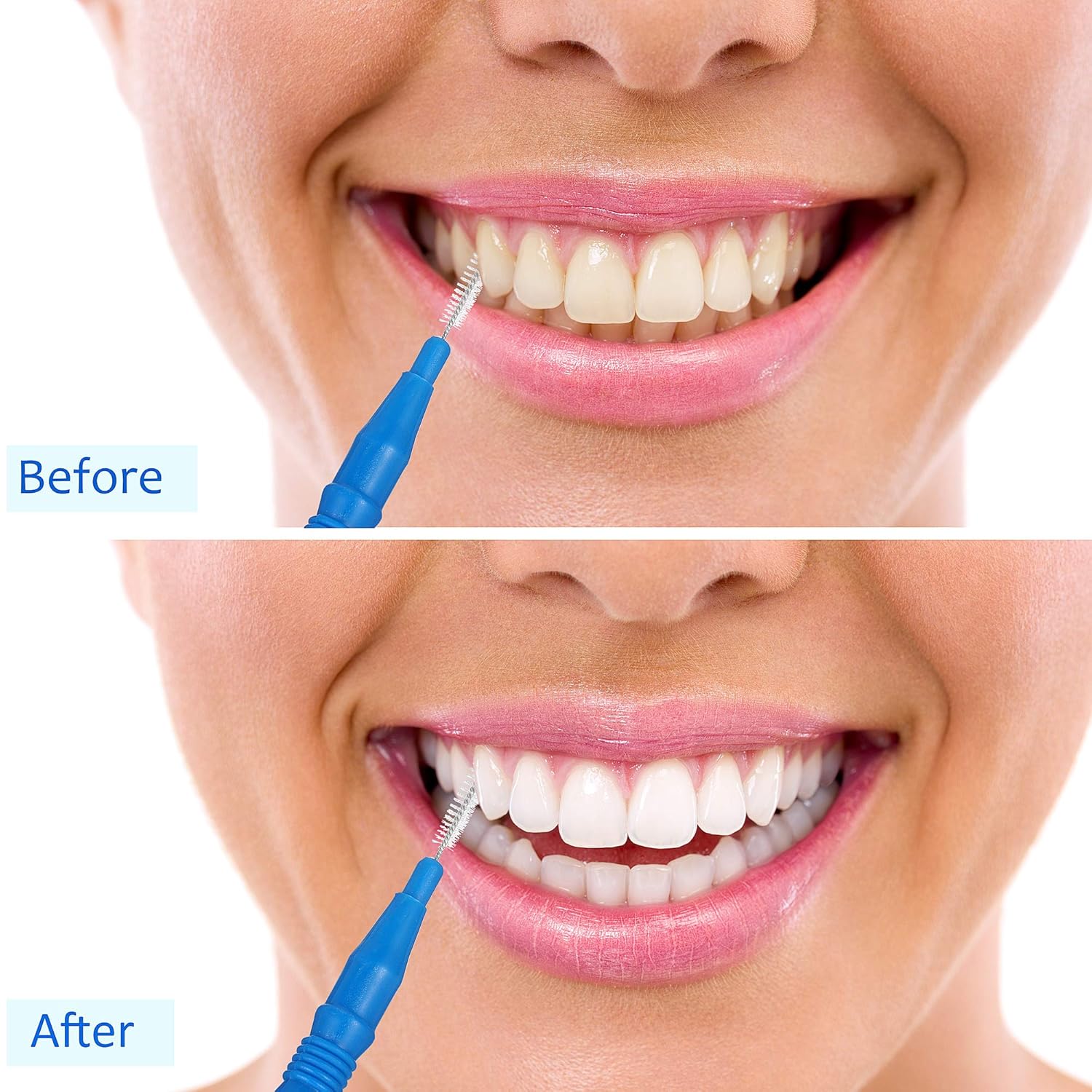 100 Pcs Braces Dental Brush Flosser for Cleaner Interdental Brush Toothpick Tooth Flossing Head Oral Dental Toothpick Cleaners Cleaning Tool Red and Blue