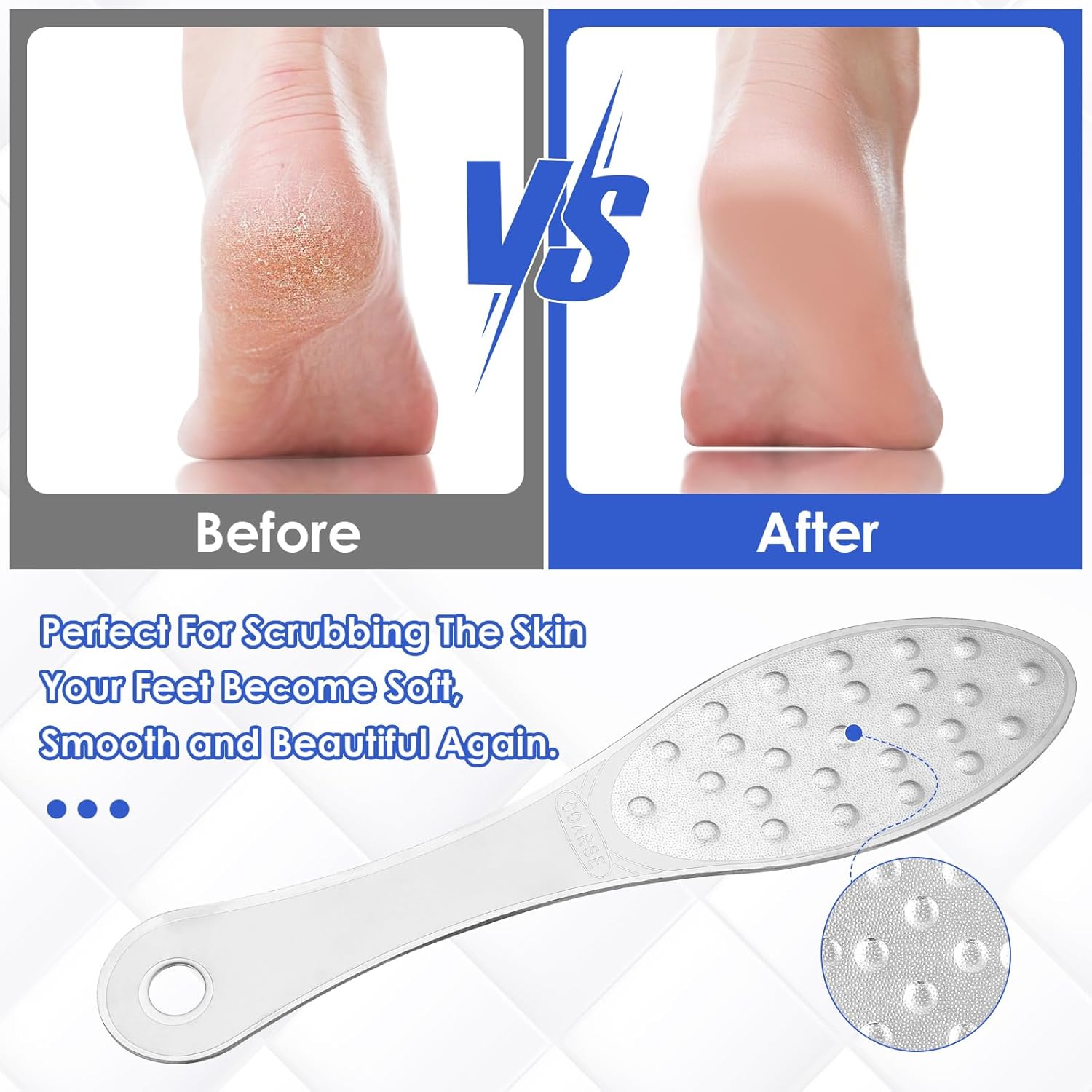 2 Pcs Foot Scraper Pedicure Metal Foot File Callus Remover for Feet Double Sided Foot Exfoliator Tool Set Foot Scrubber Professional Foot Rasp Scrubber for Wet Dry Skin Heel Silver