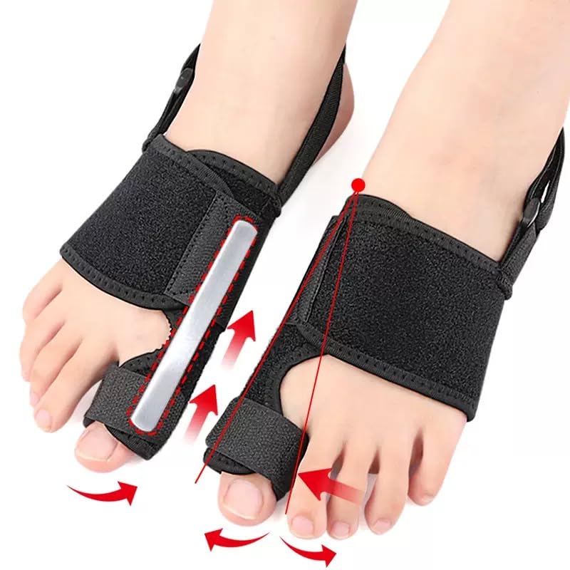 Recovist Bunion Brace - Adjustable Orthopedic Splint for Hallux Valgus Correction & Pain Relief, Day & Night Wear Support for Men & Women 2PC