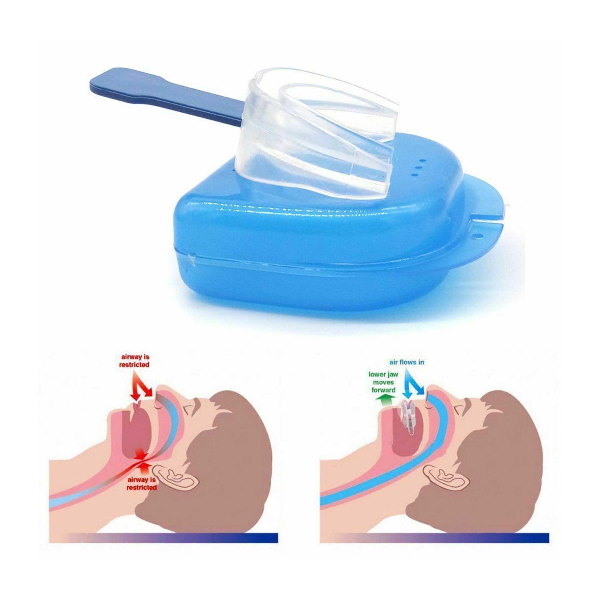 Adjustable Anti-Snoring Mouth Guard with Case, Soft Silicone