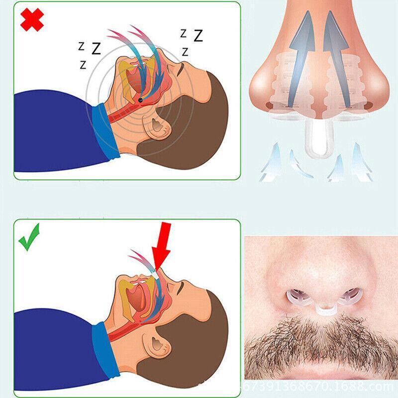 PE Nasal Vent Clip for Comfortable Breathing Airflow Support Accessory