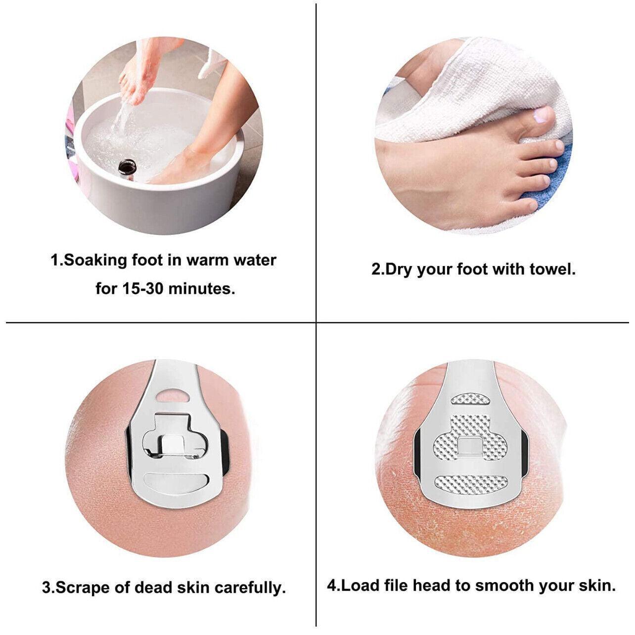 Foot File Hard Skin Remover Callus Shaver Corn Cutter Tool Pedicure + 10 Blades