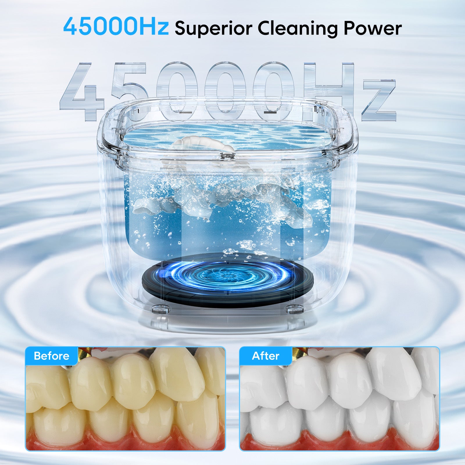 Professional Ultrasonic Cleaner with UV Light - 45000Hz for Dentures, Retainers, Jewelry & More black
