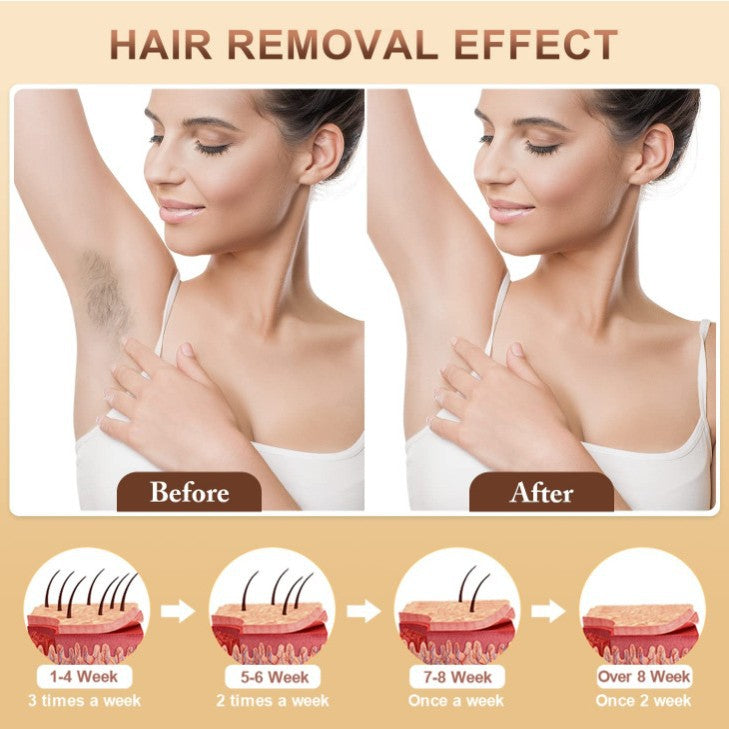 IPL Hair Removal Device - 3-in-1 Permanent Hair Reduction, Skin Rejuvenation & Acne Control white